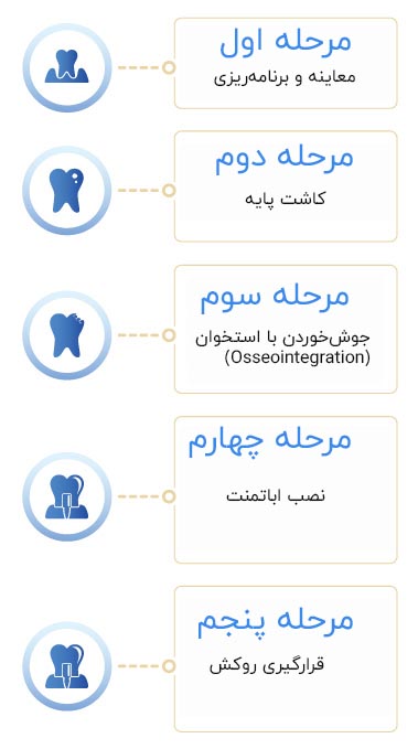 اینفوگراف مراحل انجام ایمپلنت