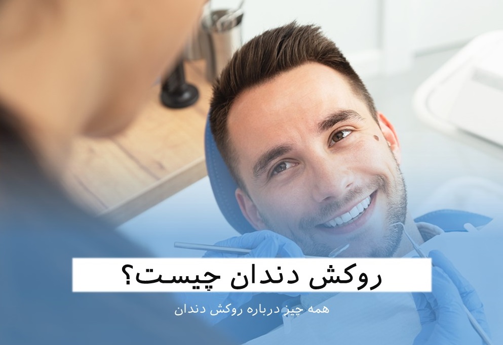 روکش دندان چیست؟